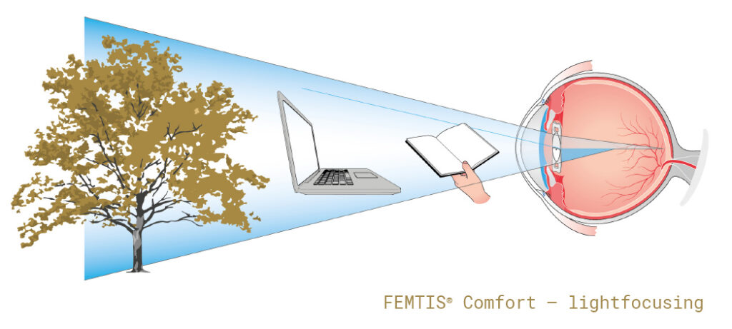 femtis_comfort_lightfocusing