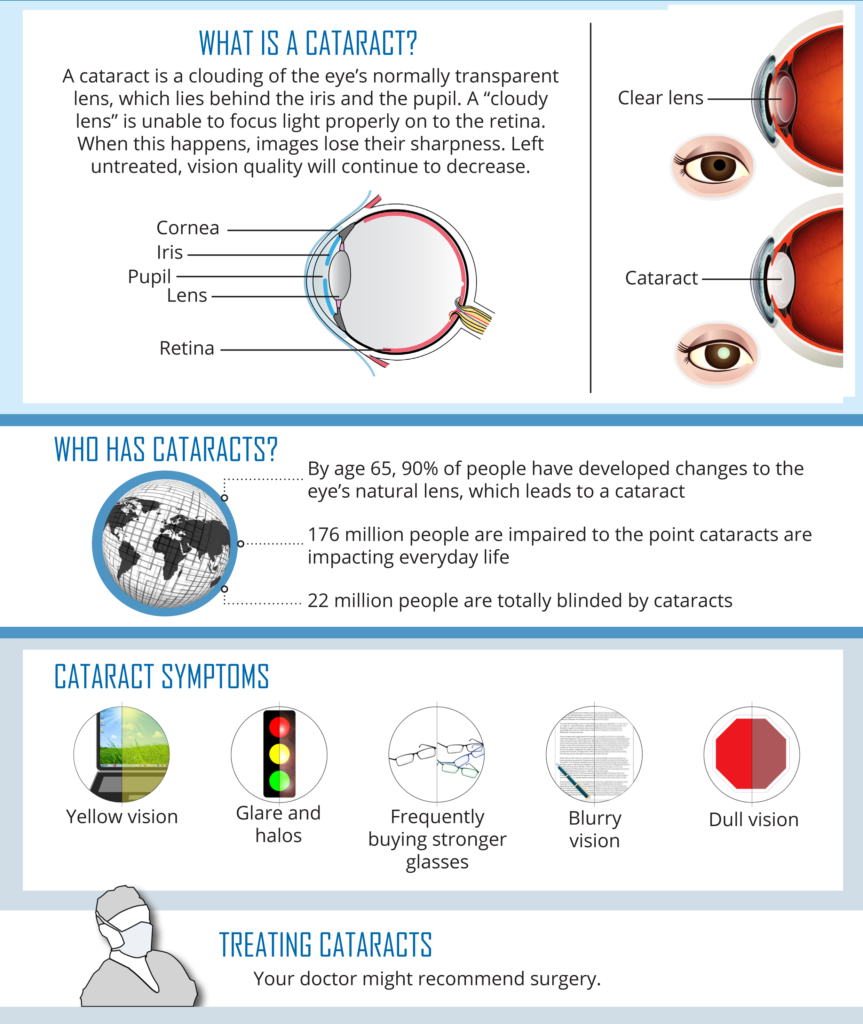 What is a cataract